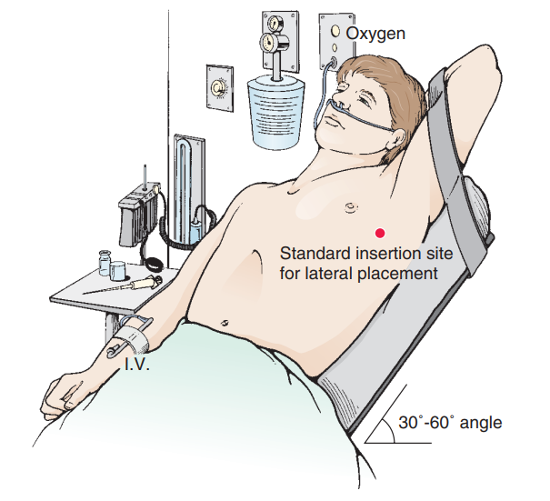 Posicionamento do paciente para drenagem pleural fechada 
