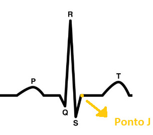 Imagem ilustrativa atrelada ao tema do ECG normal