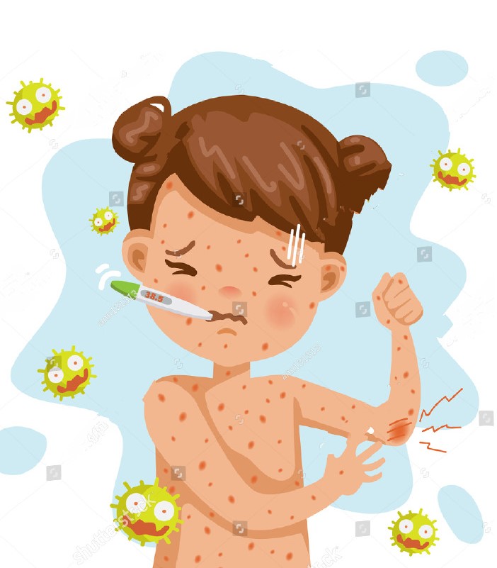 imagem ilustrativa febre maculosa
