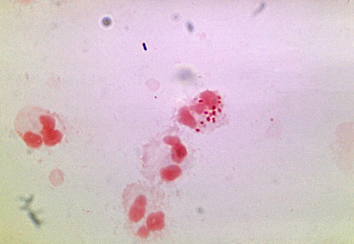 Foto de Bacterioscopia