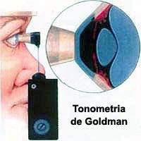 Confira a imagem 3 relacionada ao tema do glaucoma!