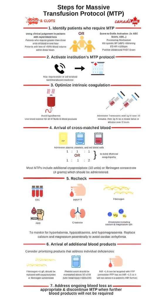 Protocolo de Transfusão Maciça - confira uma imagem ilustrativa 