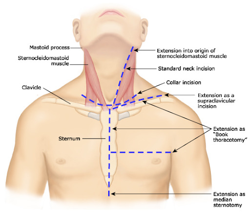 Trauma cervical - saiba mais