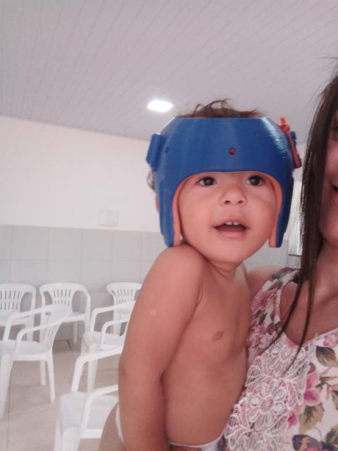 Menino de 11 meses com malformação craniana precisa de ajuda para tratamento