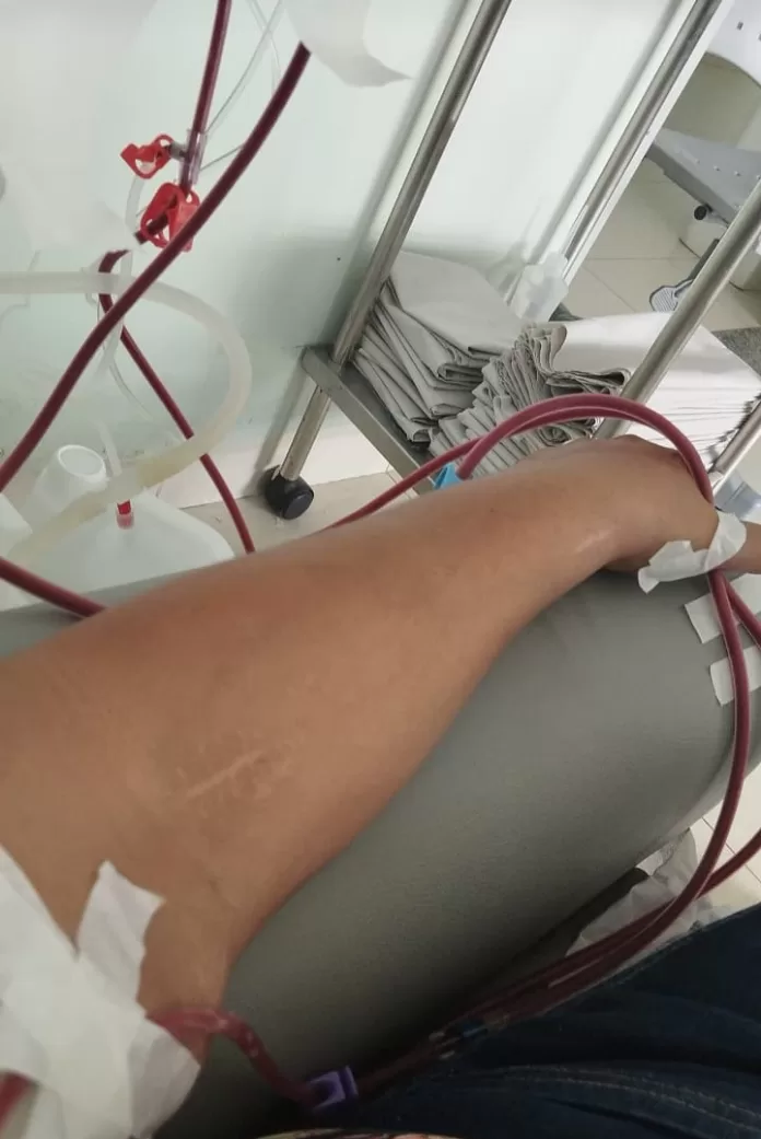 Pacientes de hemodiálise continuam denunciando falta de transporte para tratamento em ITZ