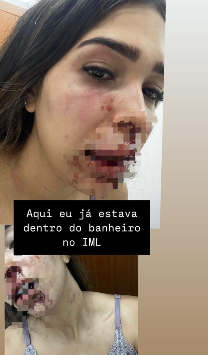 Homem é preso após agredir a namorada em Imperatriz