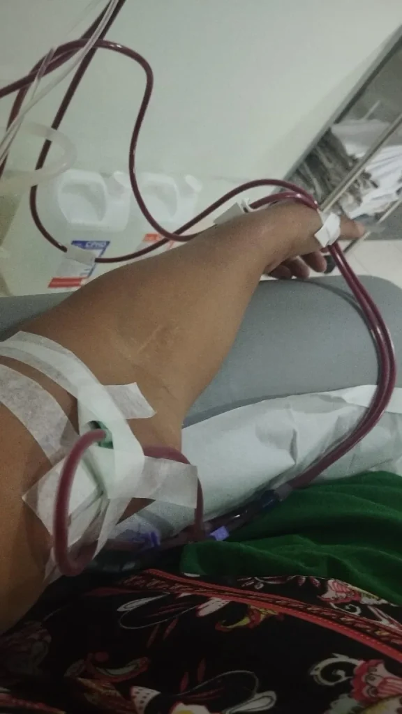 Pacientes de hemodiálise continuam denunciando falta de transporte para o tratamento em Imperatriz