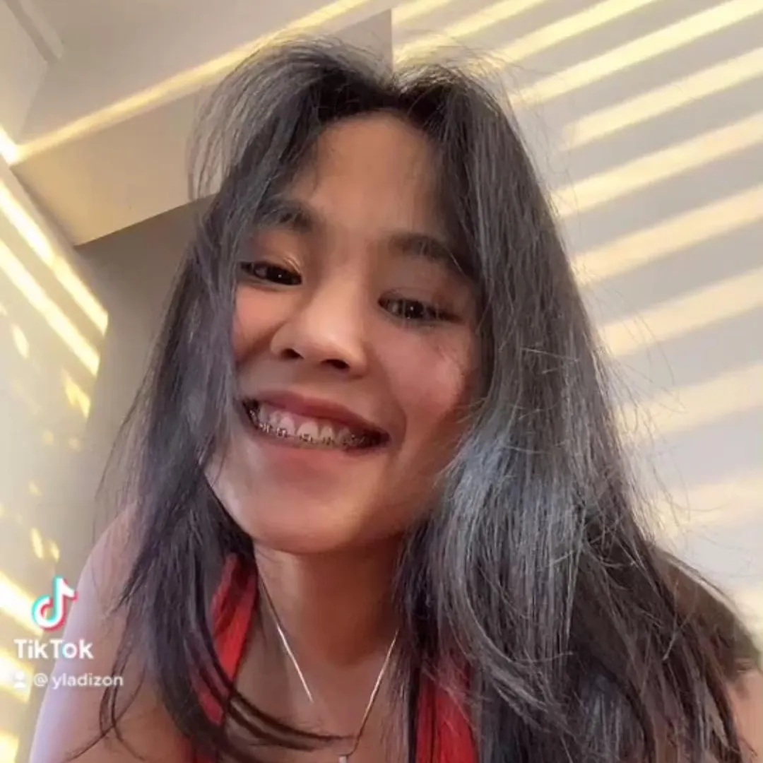 yladizon