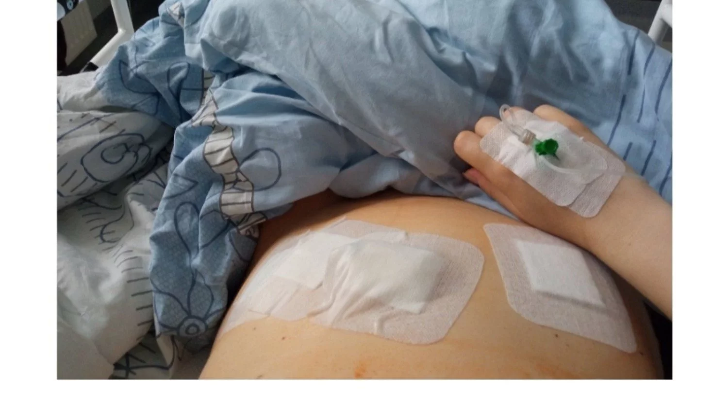 Rozruszajmy tę zbiórkę - pomóżmy Natalii żyć bez bólu