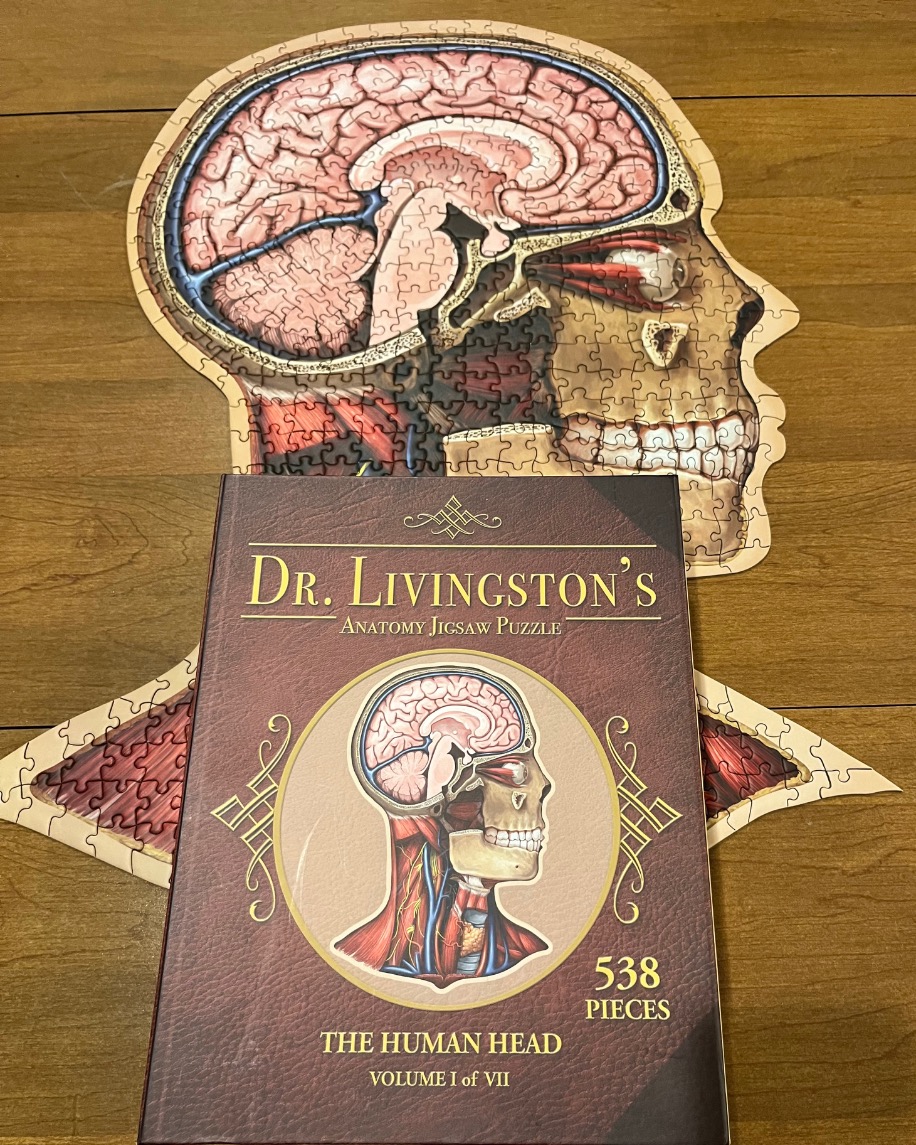 An anatomical diagram of a human head in profile, showing the brain and skull cross-section.