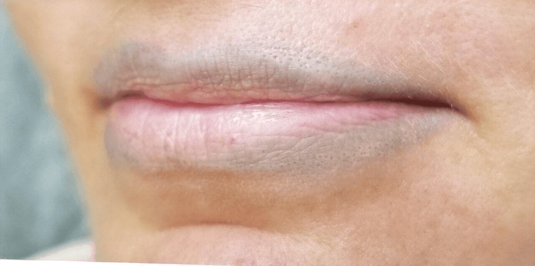 Before image