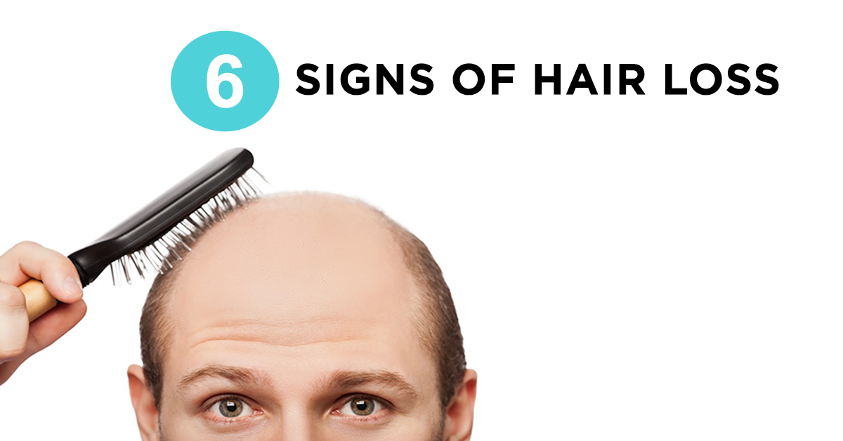 6 Early Signs You Re Going Bald 6 Ways To Fight It Irestore Laser Irestore Hair Growth System