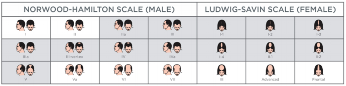 23 Ludwig Scale Hair Loss Marieazayed 9245