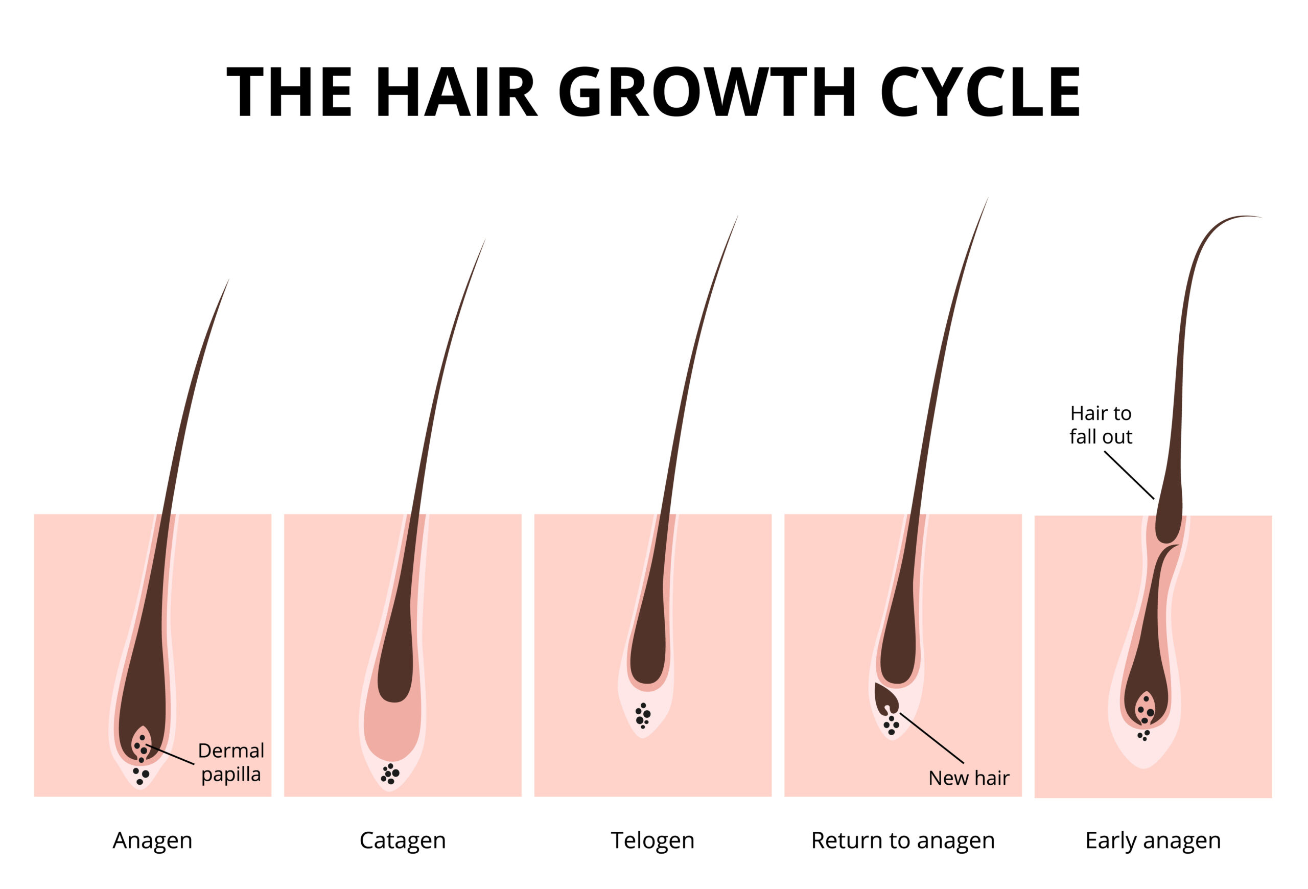 NATIONAL HAIR GROWTH MONTH: EVERYTHING YOU NEED TO KNOW - iRestore Laser -  iRestore Hair Growth System