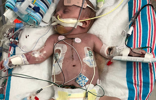Baby intubated on hospital stretcher