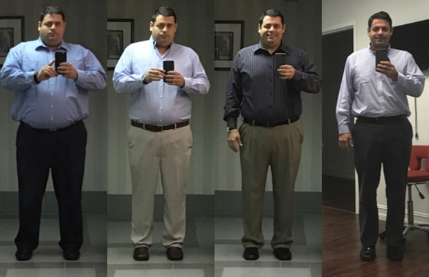Bariatrics Surgery Gives South Florida Man a Second Chance