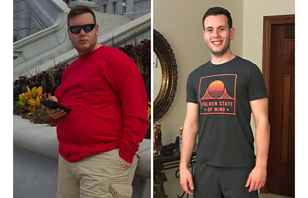 Gastric Sleeve Surgery Gives 21-Year-Old a New Beginning