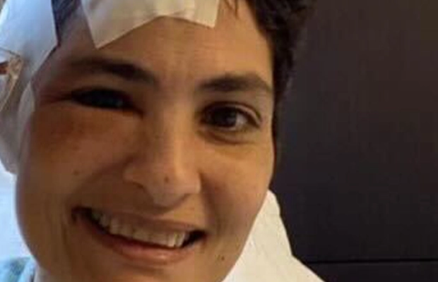 Close-up of a woman with bandages on her face