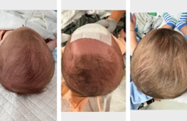 photo collage of a baby's head
