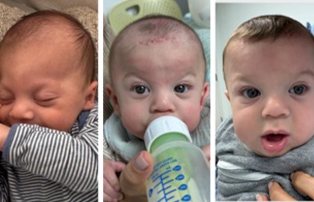 baby photo collage