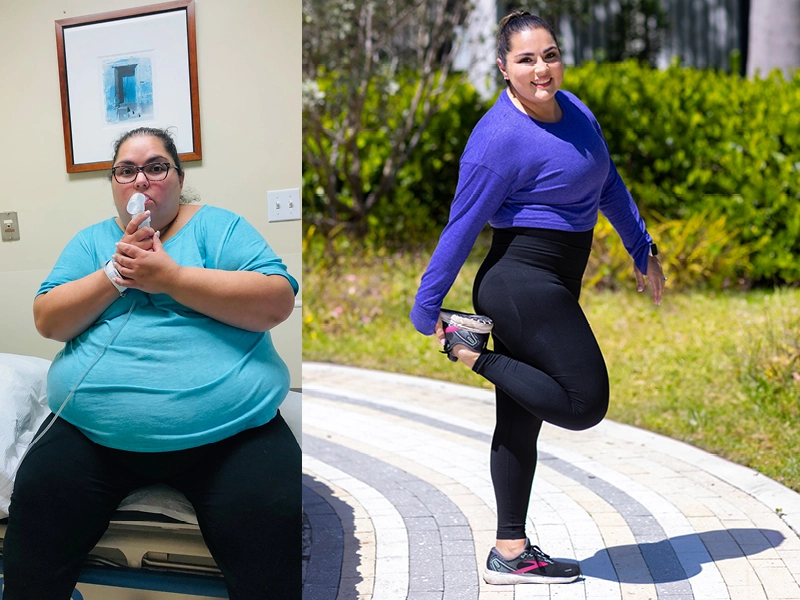 South Florida Mother Undergoes Dramatic Weight-loss Transformation