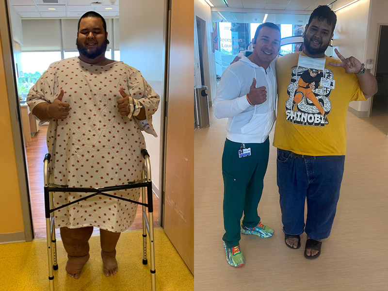 South Florida Man Battling Obesity Transforms into Bodybuilding World  Champion after Undergoing Bariatric Surgery