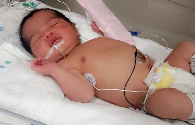 small baby sleeping with tubes connected to him
