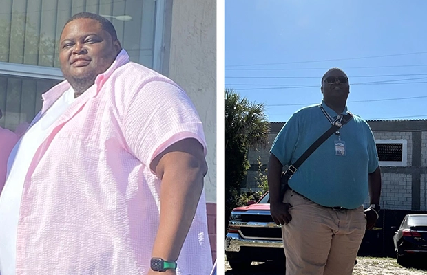 before and after a man who suffered from obesity