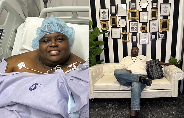 before and after a man who suffered from obesity