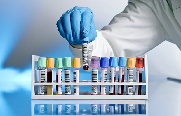 closeup of hand manipulating medicines in bottles