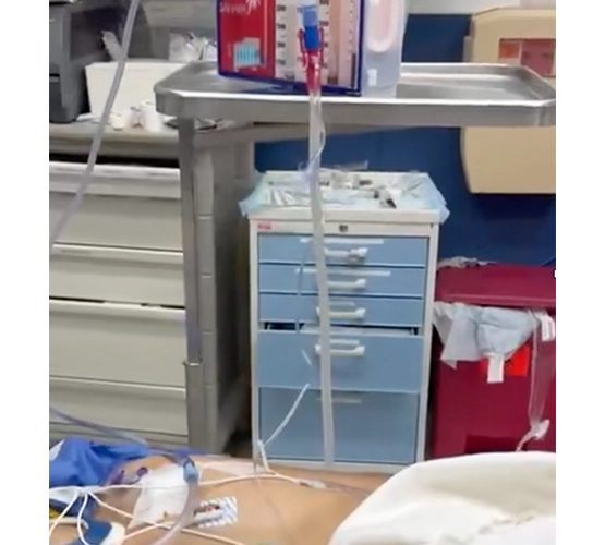 hospital tubing connected to a person