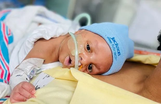 A small baby intubated on a hospital stretcher