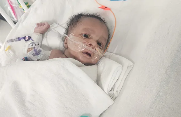A small baby intubated on a hospital stretcher
