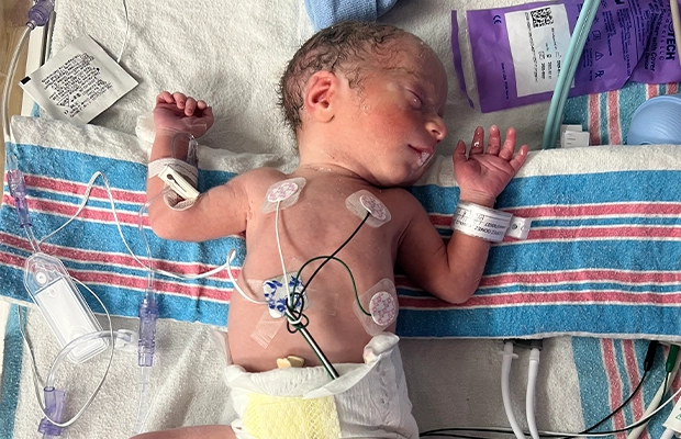 small baby with a breathing tube