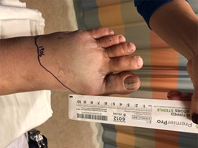 image of a foot next to a meter