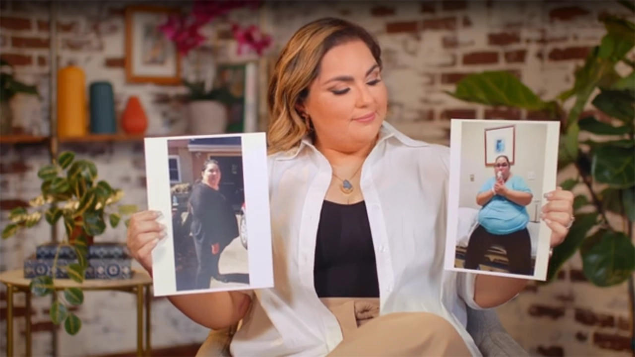 A woman holding images of her before her weight loss surgery
