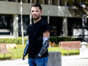 A young man standing outside, he has two hand casts