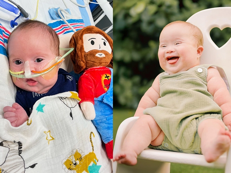 before and after a sick baby