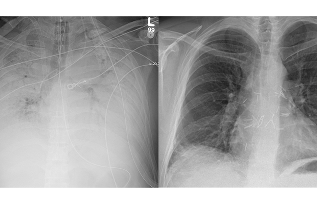 x-ray before and after