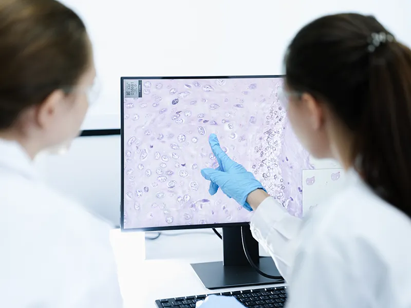 Two medical professionals in white lab coats reviewing a histology slide displayed on a computer monitor, with one pointing at the microscopic tissue sample on screen while wearing a blue latex glove.