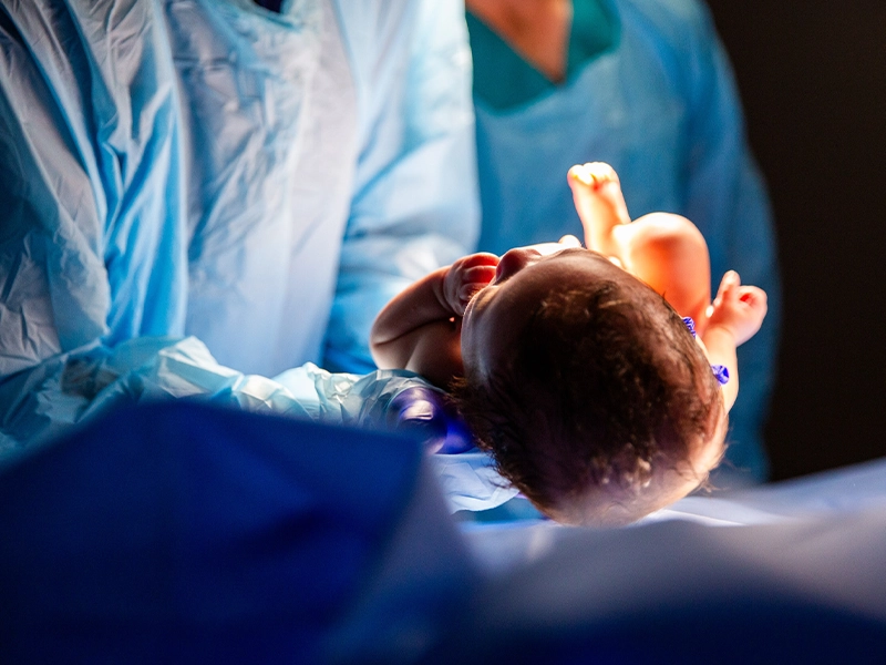 Close-up of a newborn being held by the doctor.