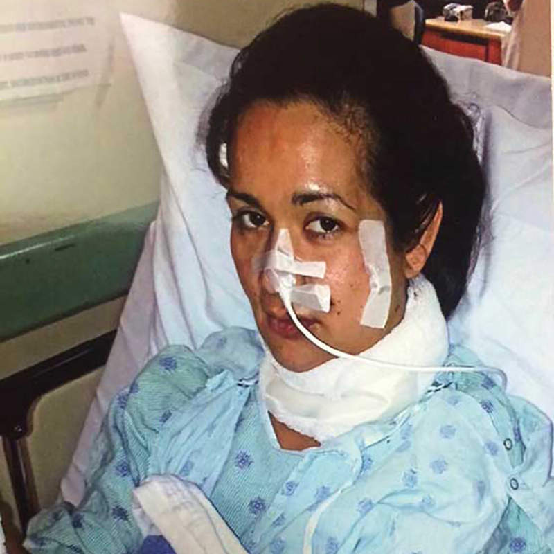 Evelin Matamoros on a hospital bed, she has a bandage on her left cheek, nose, and around her neck