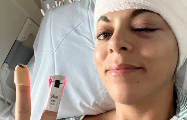 woman lying on a hospital gurney wearing bandages on her body