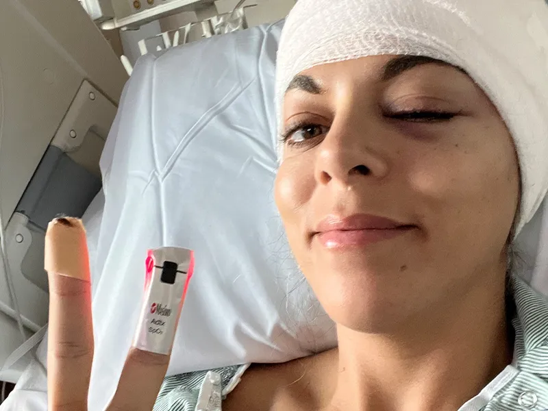 woman lying on a hospital gurney wearing bandages on her body