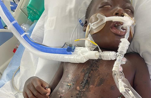 Intubated child showing visible wounds at the end of surgery