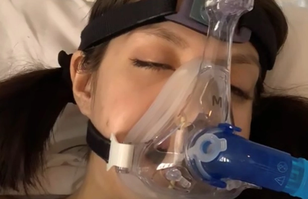 young intubated woman lying in hospital bed