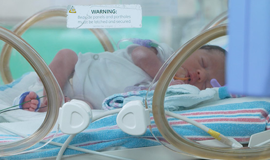 A small baby in an incubator
