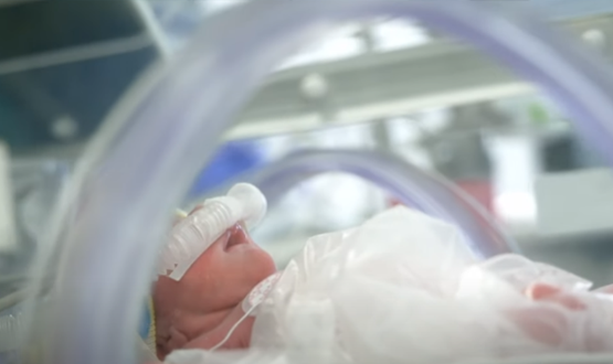 A small baby in an incubator