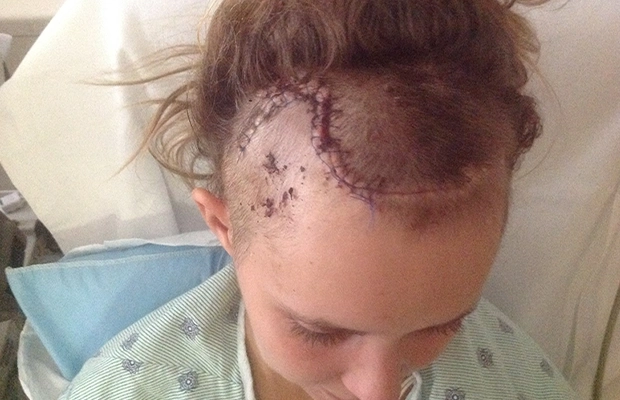 Close-up of scarring on the head.