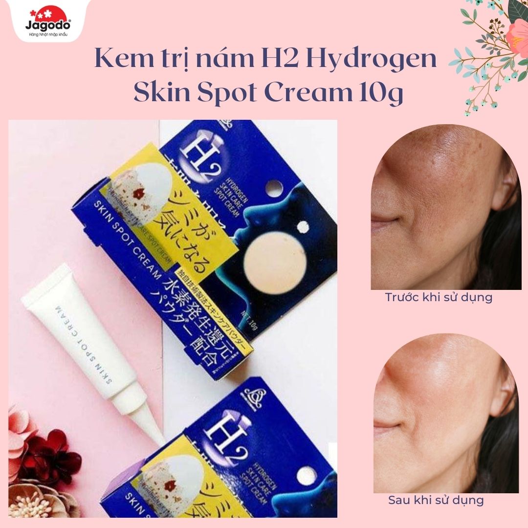 Kem trị nám H2 Hydrogen Skin Spot Cream 10g